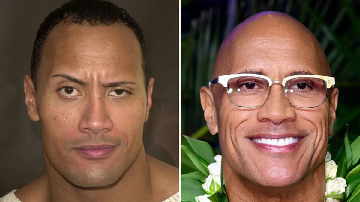 Dwayne Johnson Then and Now: Good Genes or Good Docs?
