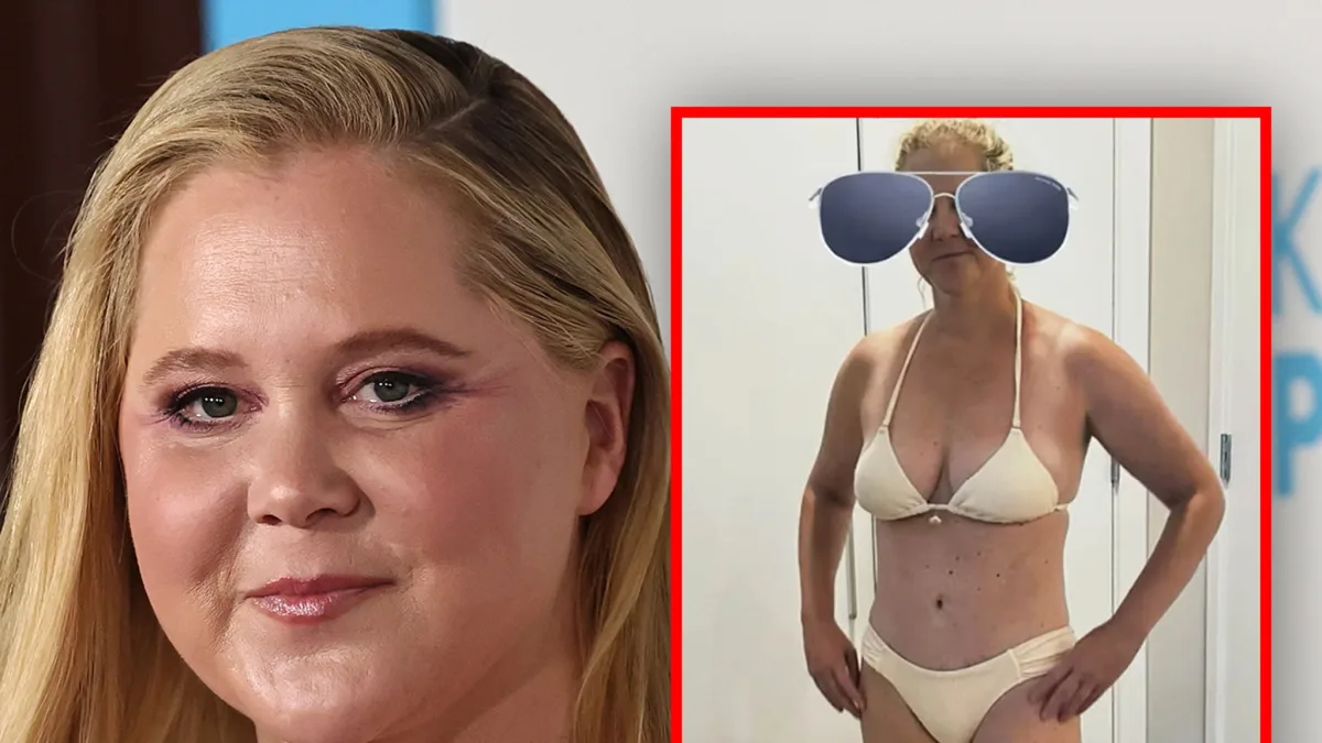 Amy Schumer Shows Off Slim Figure in Bikini After Weight Loss